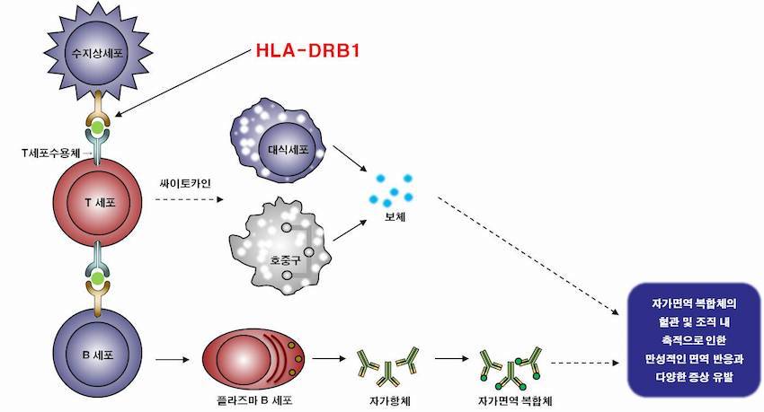 그림1_루푸스 발병기작에서 HLA-DRB1의 역할